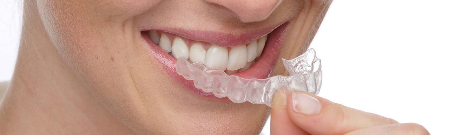 A Better Orthodontic Solution — Fix Your Smile With Invisalign